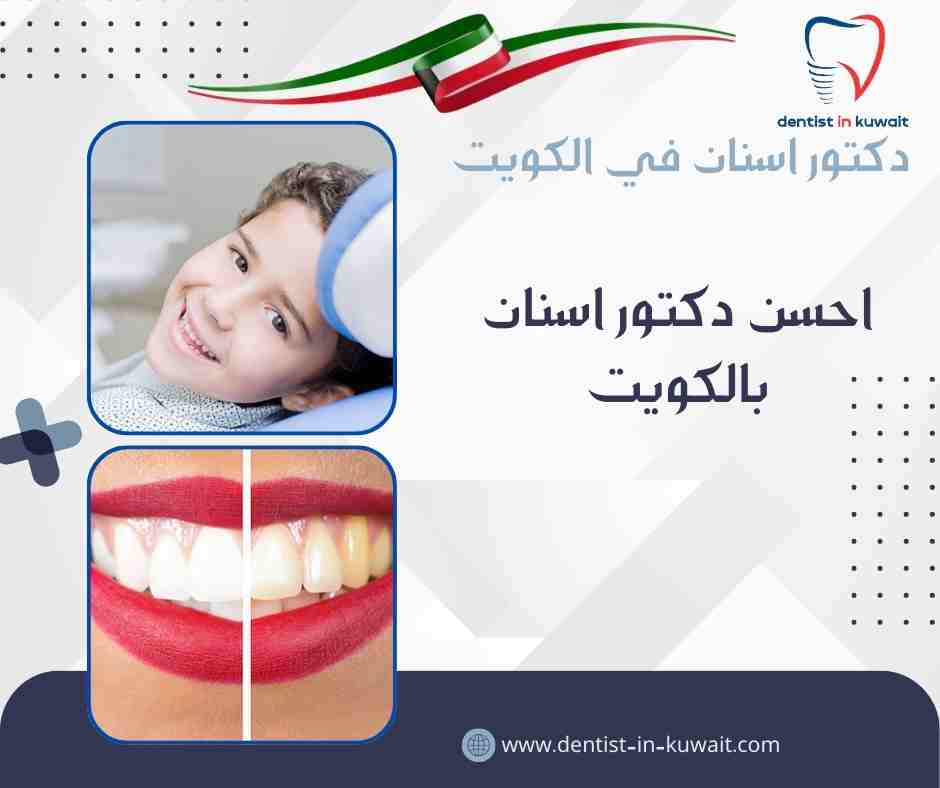 احسن دكتور اسنان بالكويت