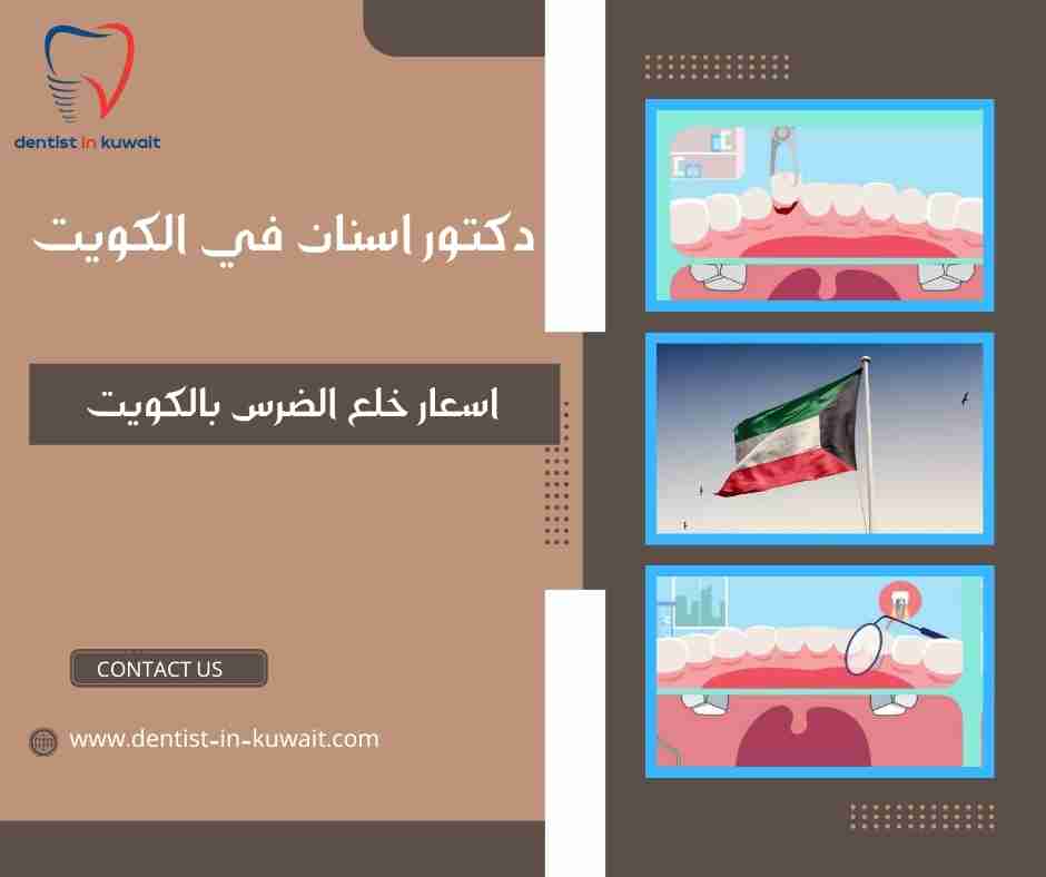 اسعار خلع الضرس بالكويت