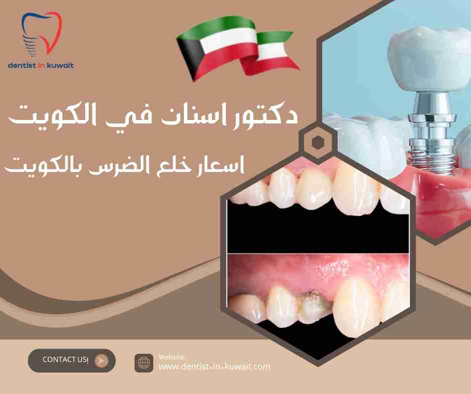 اسعار خلع الضرس بالكويت