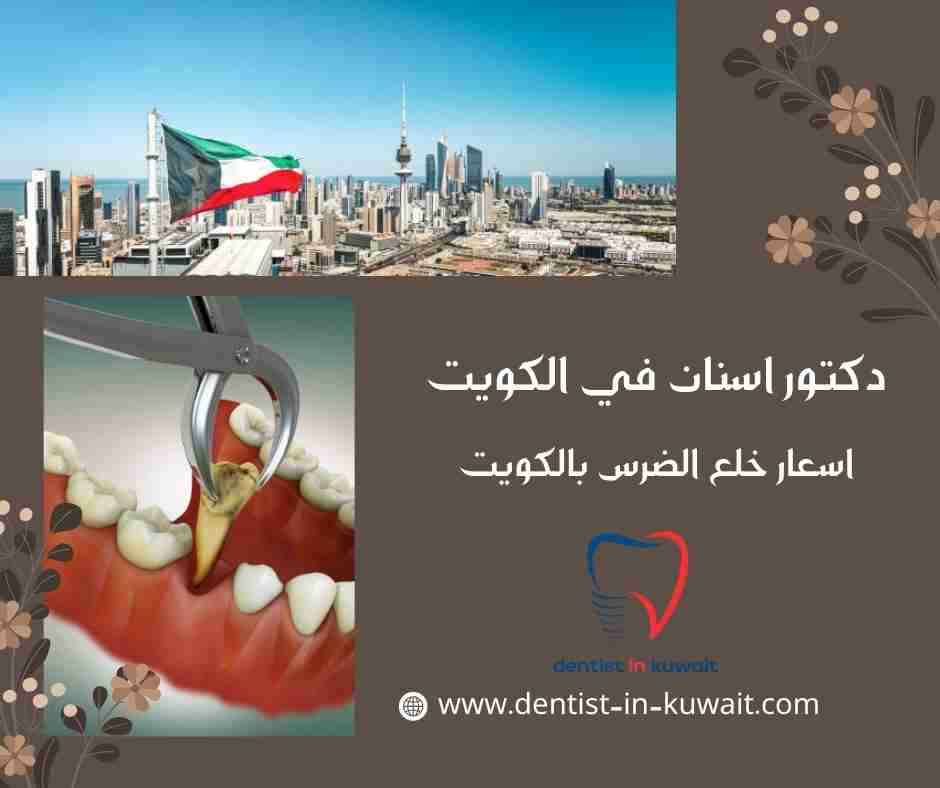 اسعار خلع الضرس بالكويت