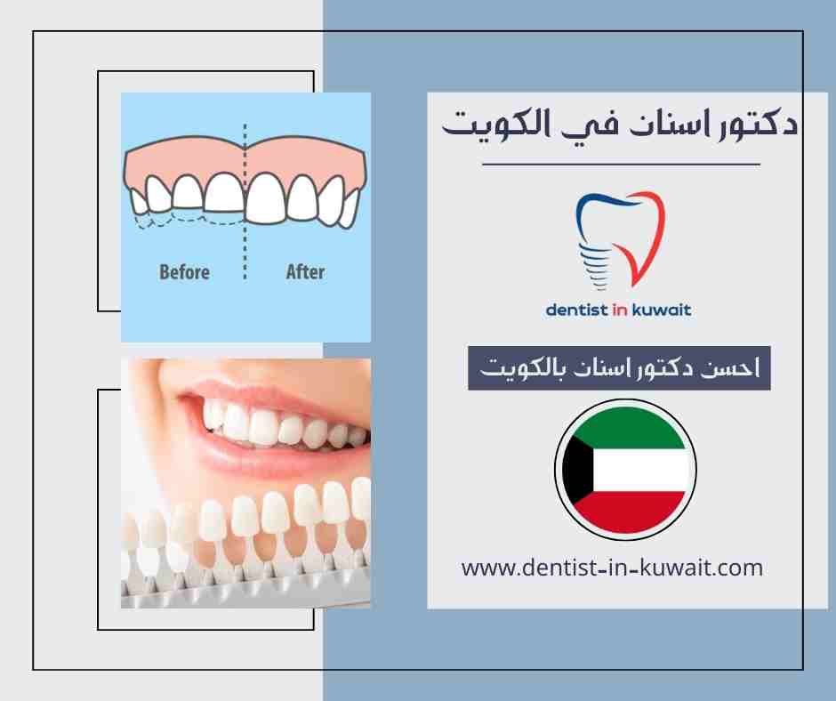 احسن دكتور اسنان بالكويت