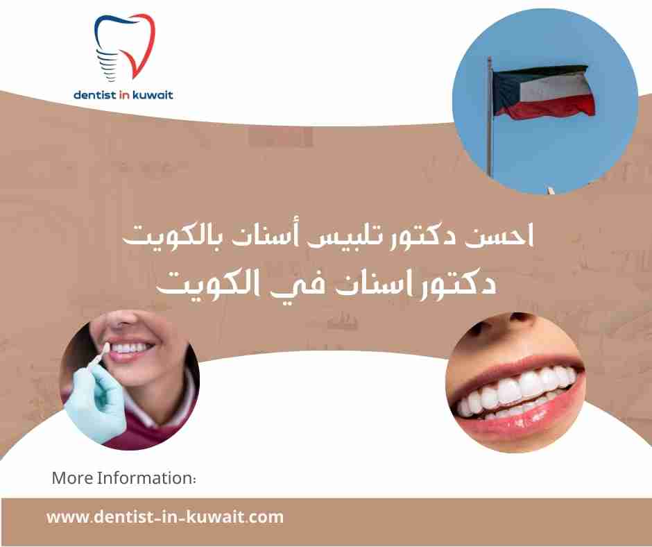 احسن دكتور تلبيس أسنان بالكويت