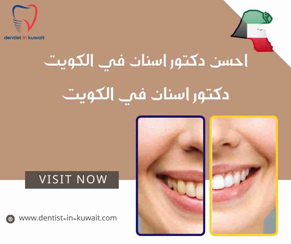 احسن دكتور اسنان في الكويت