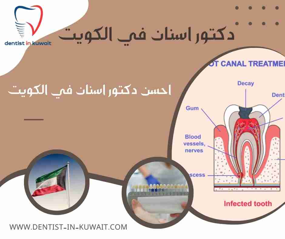 احسن دكتور اسنان في الكويت