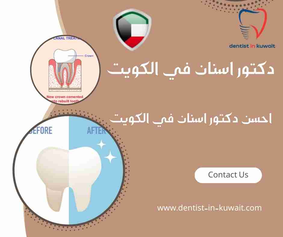 احسن دكتور اسنان في الكويت