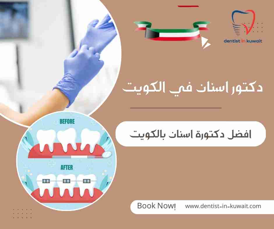 افضل دكتورة اسنان بالكويت