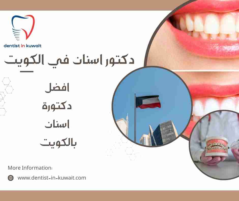 افضل دكتورة اسنان بالكويت