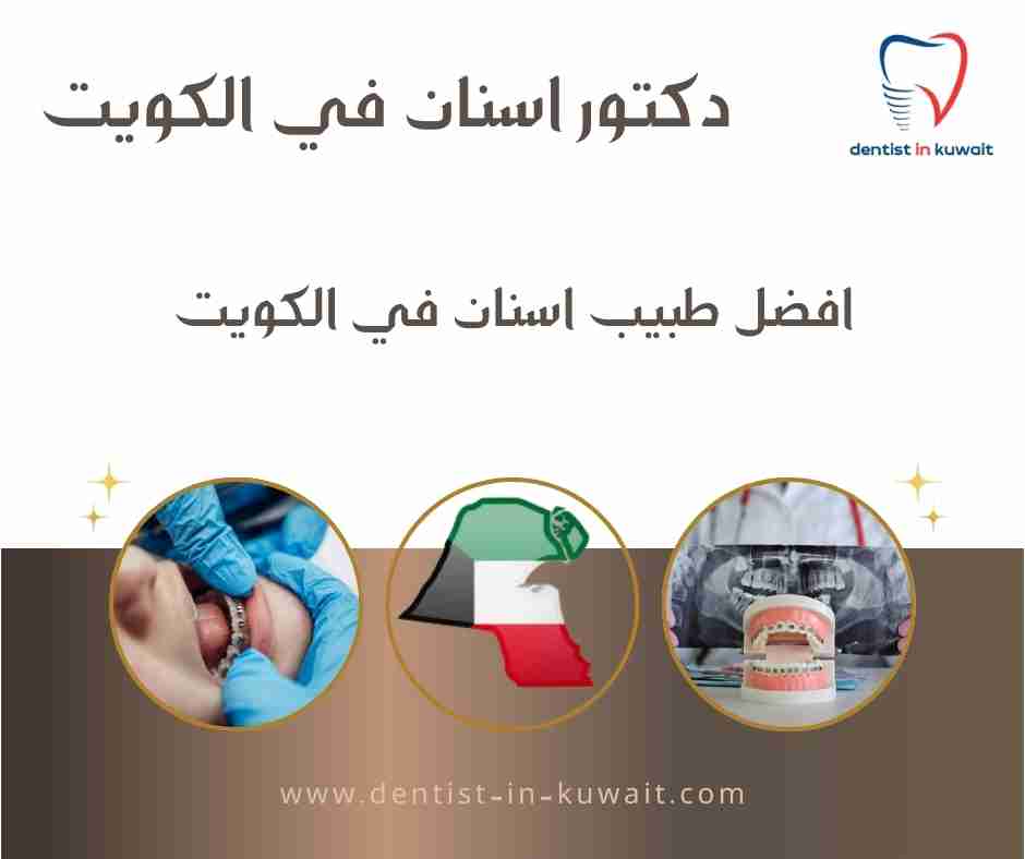 افضل طبيب اسنان في الكويت