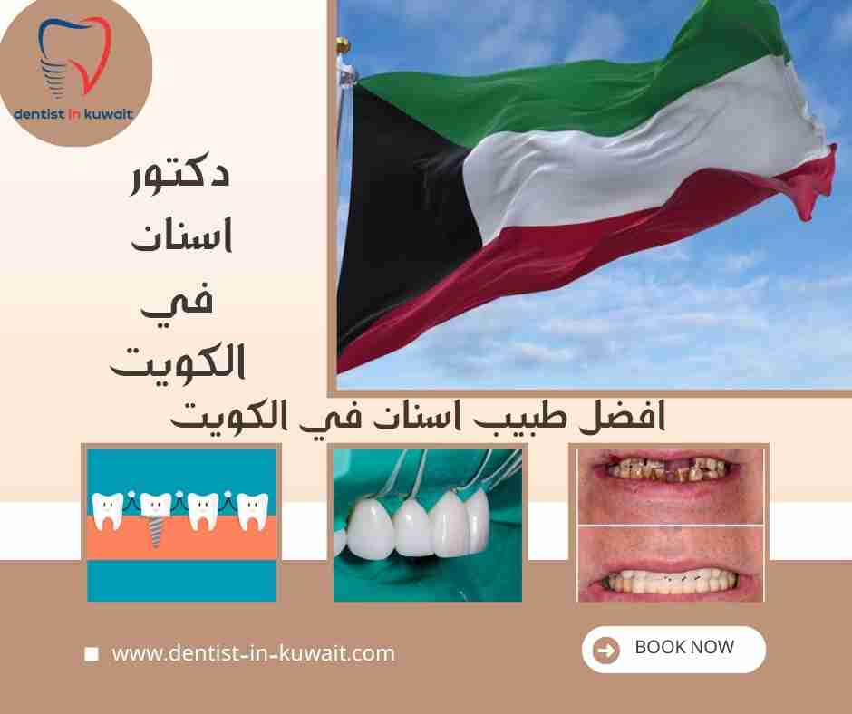 افضل طبيب اسنان في الكويت