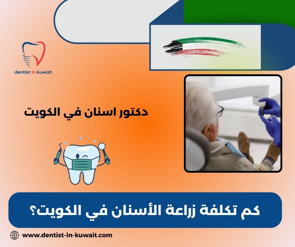 ما هي أفضل شركات زراعة الأسنان؟