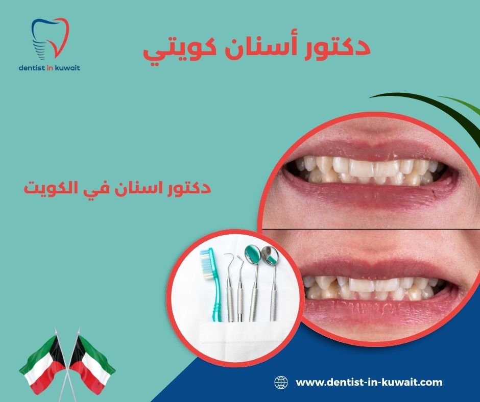 دكتور أسنان كويتي