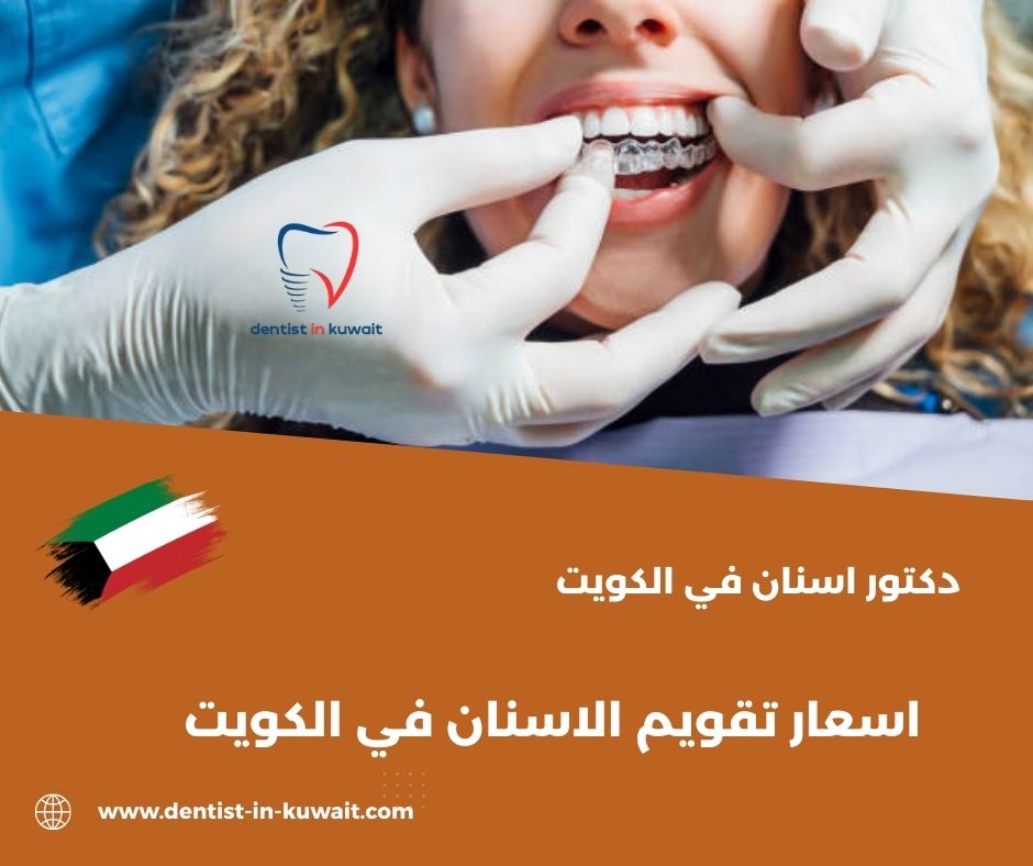 اسعار تقويم الاسنان في الكويت