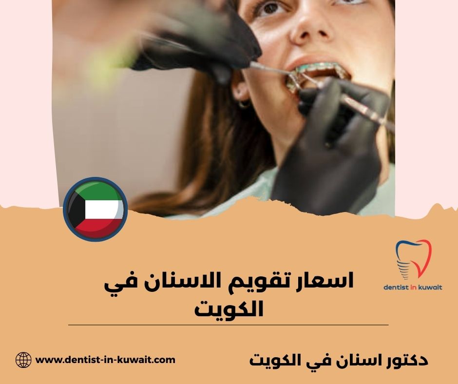 اسعار تقويم الاسنان الكويت