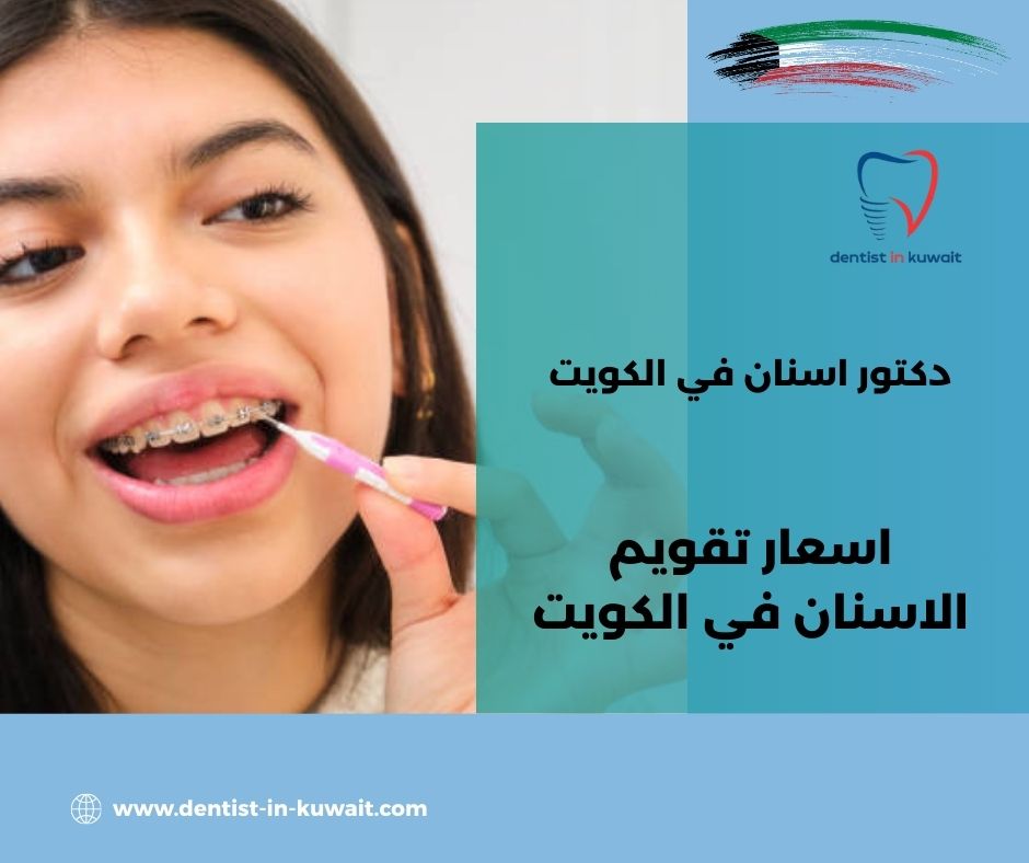 تقويم الاسنان بالكويت