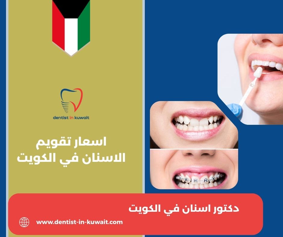 اسعار تقويم الاسنان في الكويت