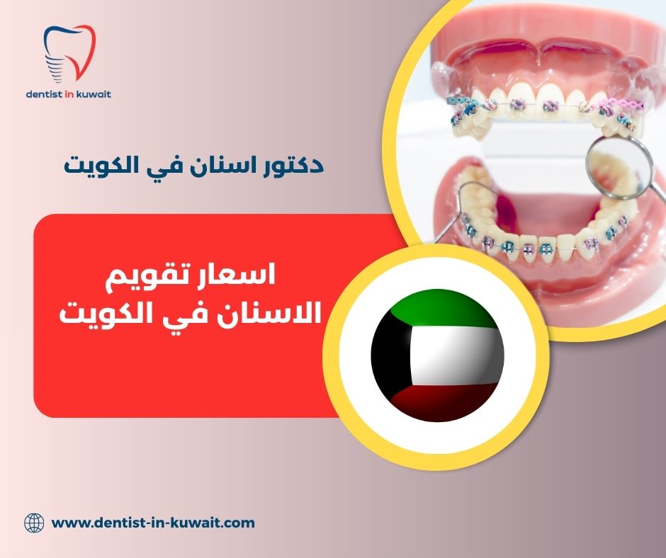 تقويم الاسنان في الكويت