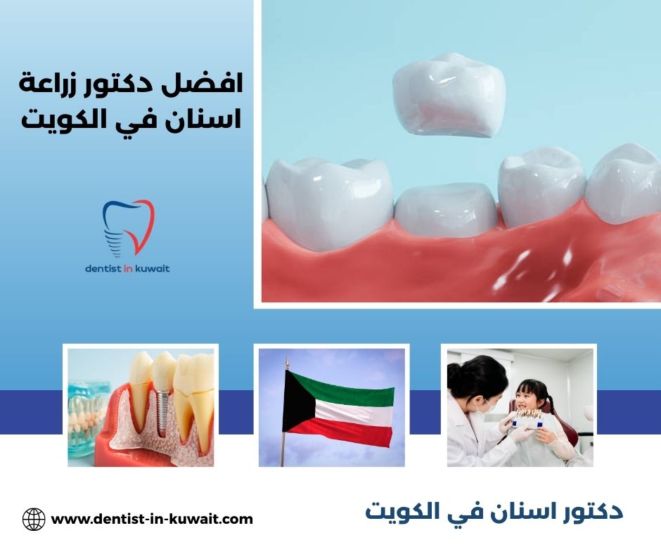 كم تبلغ تكلفة الزراعة عند افضل دكتور زراعة اسنان في الكويت مقارنة بالعيادات الأخرى؟ كم تبلغ تكلفة الزراعة عند افضل دكتور زراعة اسنان في الكويت مقارنة بالعيادات الأخرى؟