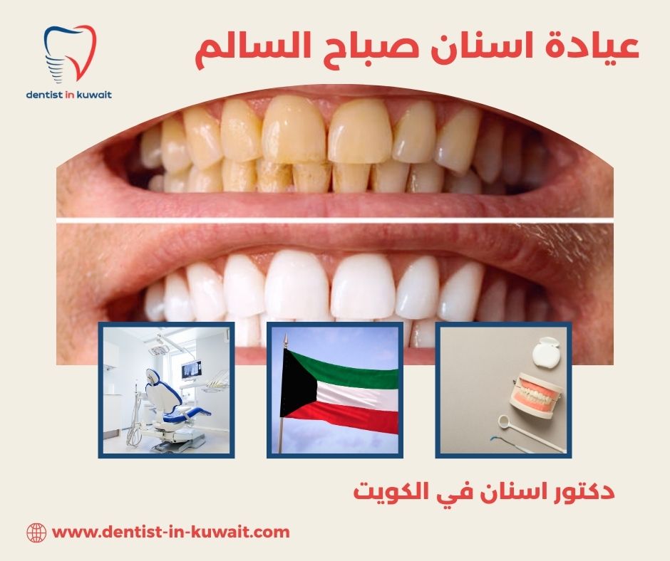 عيادة اسنان صباح السالم