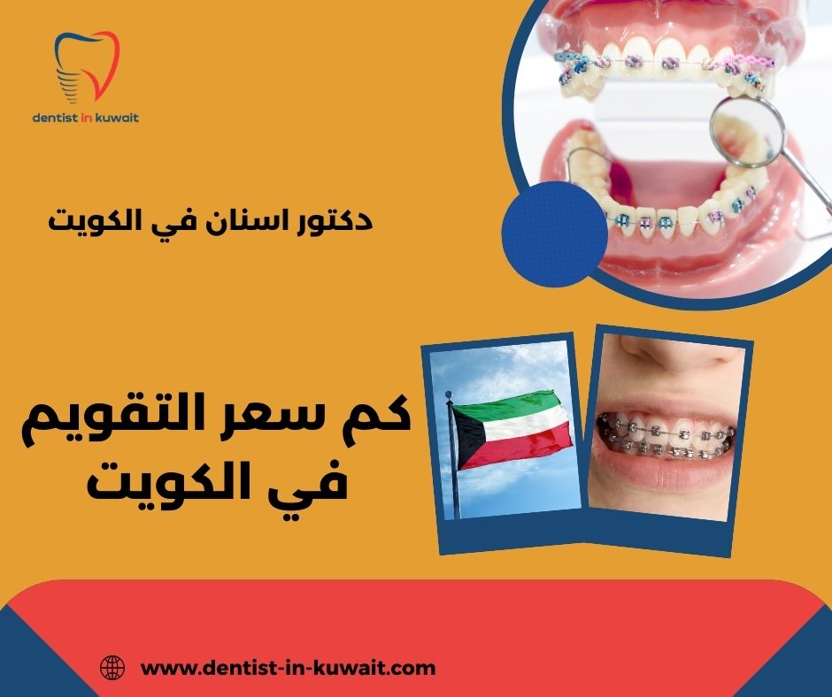 كم سعر التقويم الشفاف في الكويت