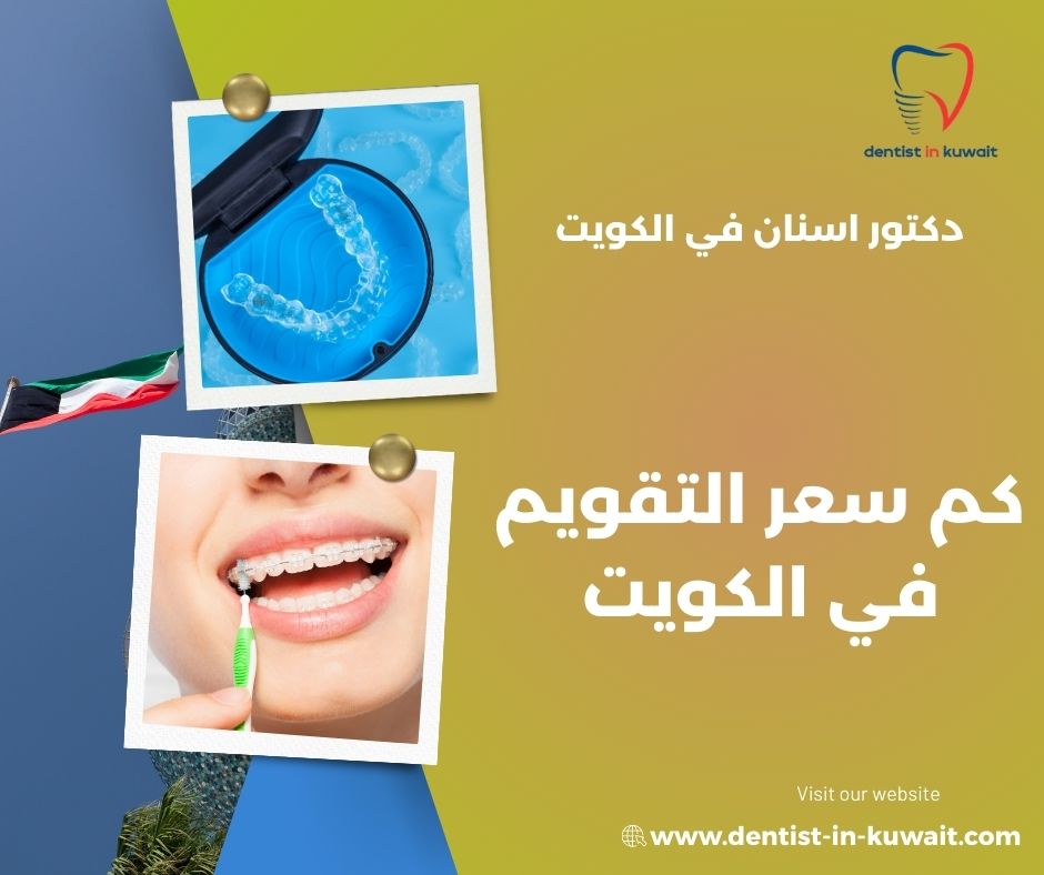 كم سعر تركيب التقويم في الكويت