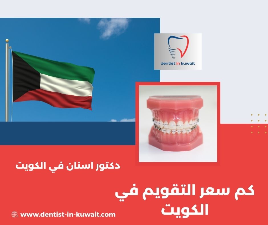كم سعر التقويم الاسنان في الكويت
