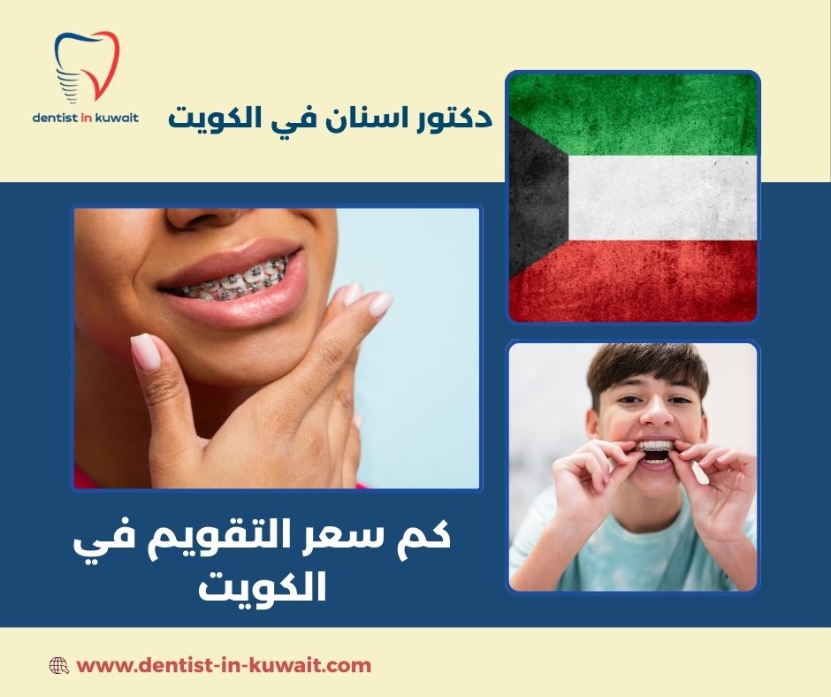 كم سعر التقويم المعدني في الكويت