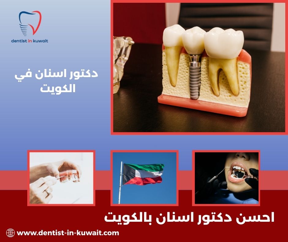 احسن دكتور اسنان في الكويت
