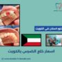 اسعار خلع الضرس بالكويت