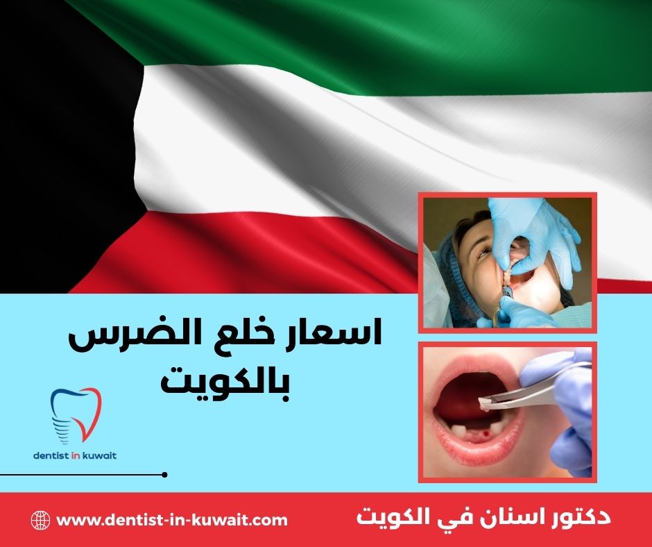 أسعار خلع الضرس بالكويت أسعار خلع الضرس بالكويت
