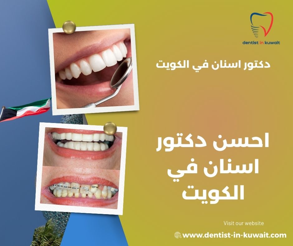 احسن دكتور اسنان في الكويت