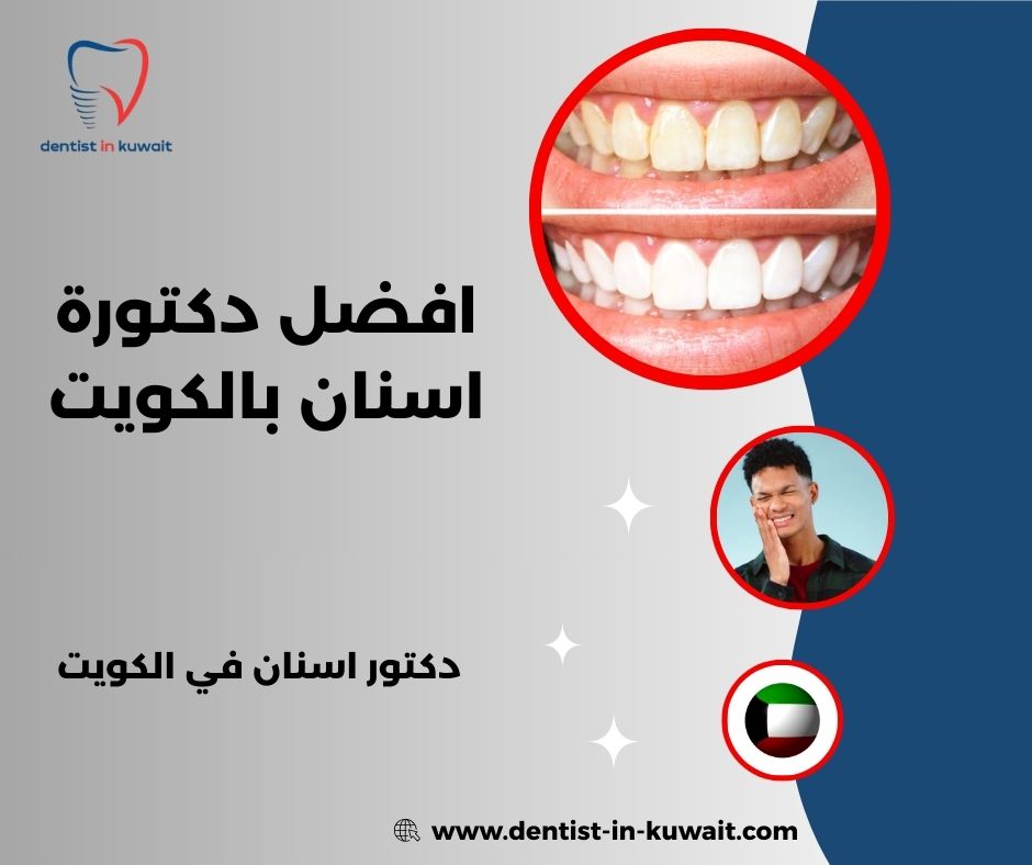 افضل دكتورة اسنان بالكويت افضل دكتورة اسنان بالكويت