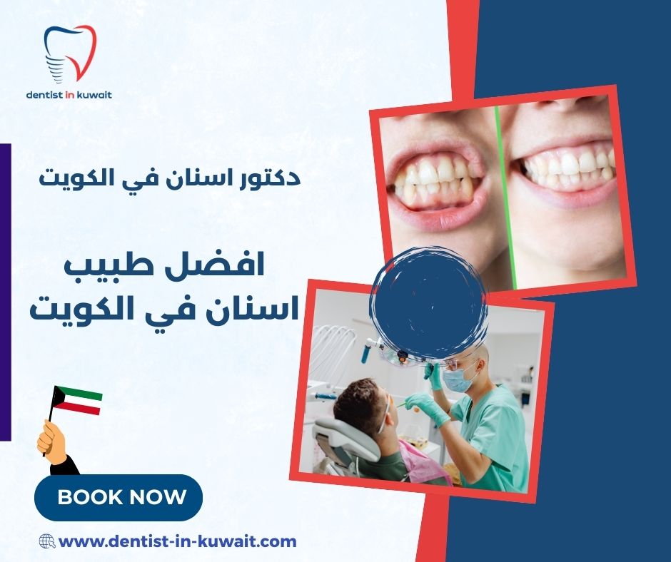 افضل طبيب اسنان في الكويت
