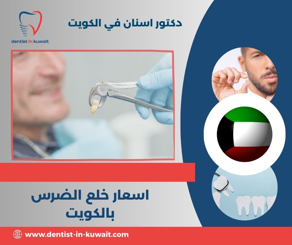 اسعار خلع الضرس بالكويت اسعار خلع الضرس بالكويت