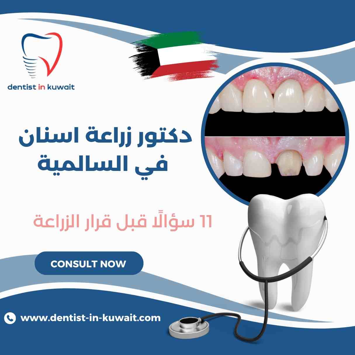 دكتور زراعة اسنان في السالمية