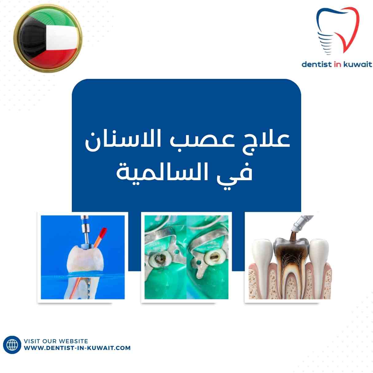 علاج عصب الاسنان في السالمية