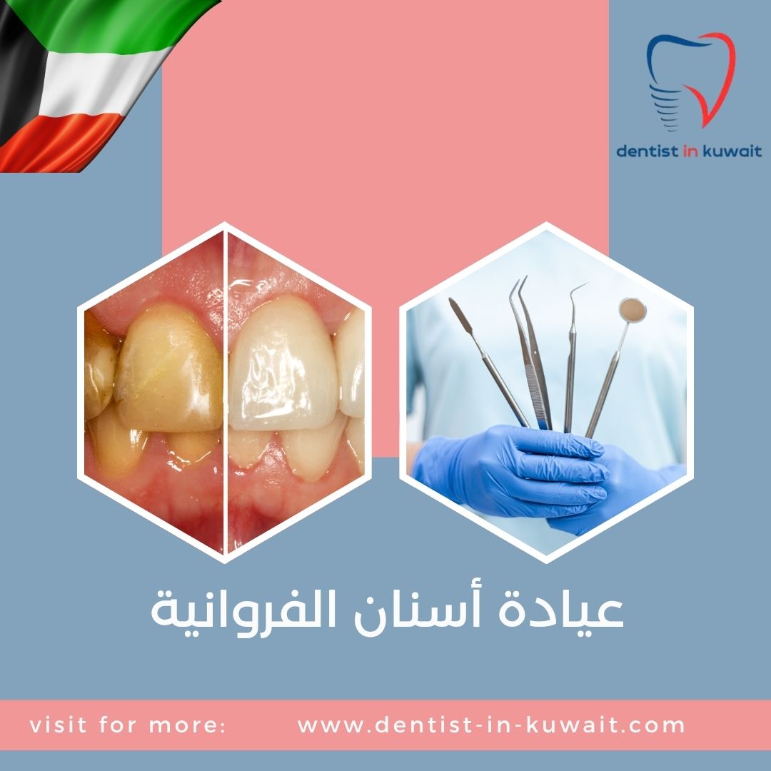 عيادة أسنان الفروانية