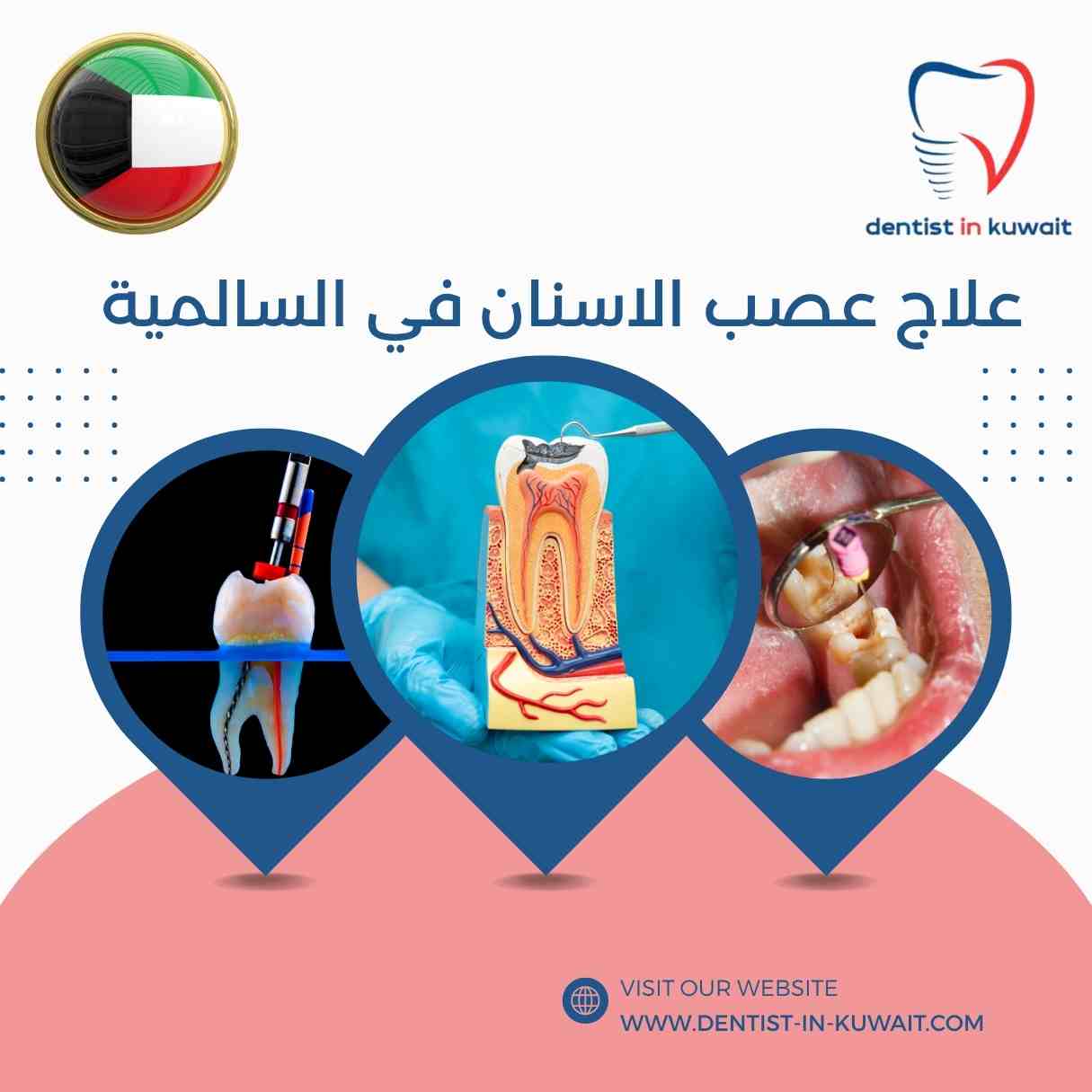 علاج عصب الاسنان في السالمية
