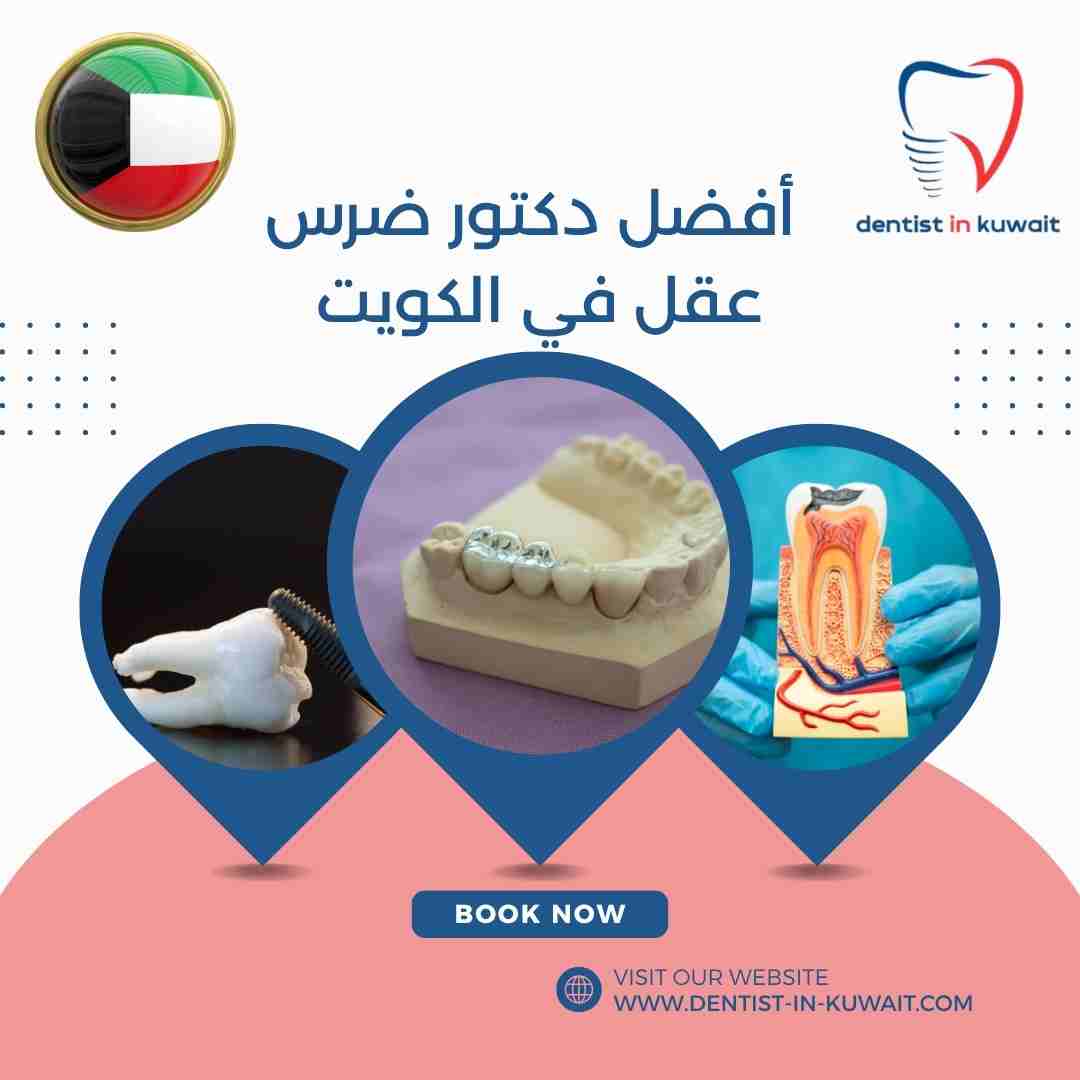 أفضل دكتور ضرس عقل في الكويت