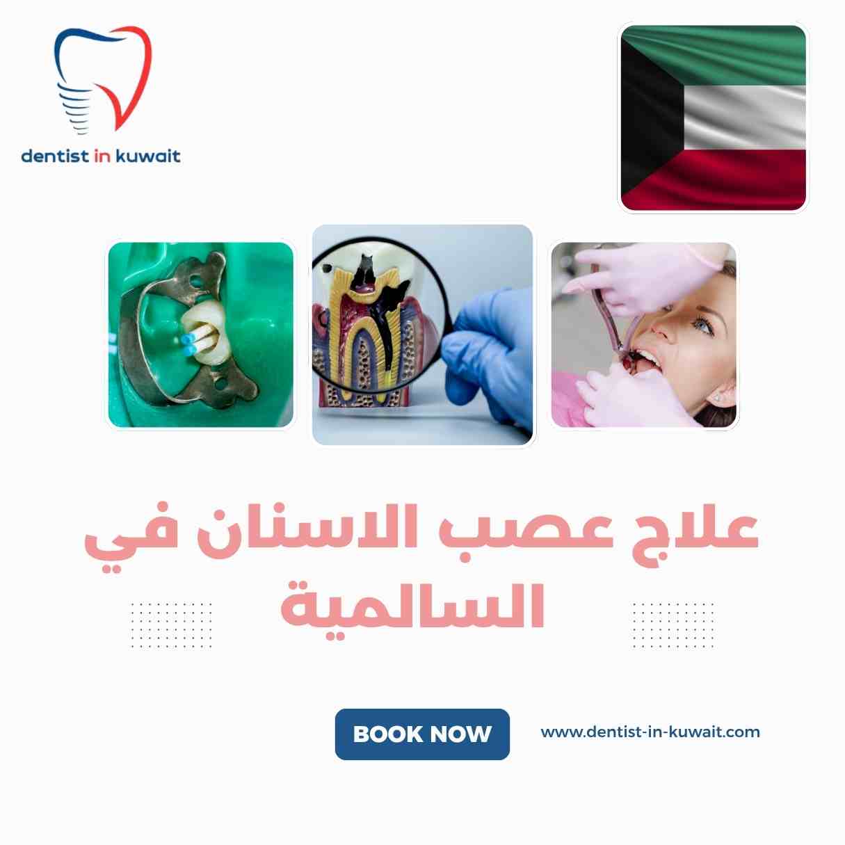 علاج عصب الاسنان في السالمية