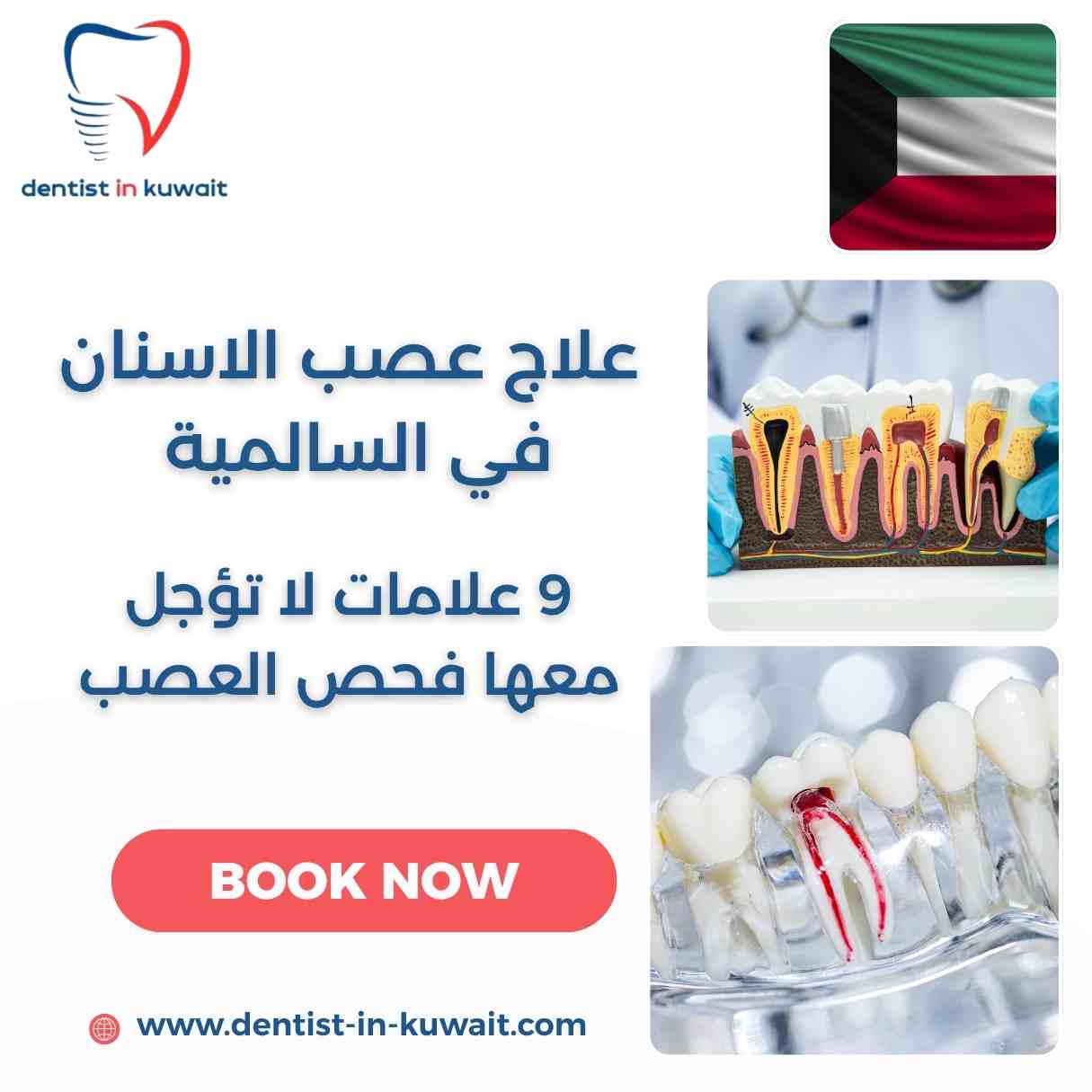 علاج عصب الاسنان في السالمية