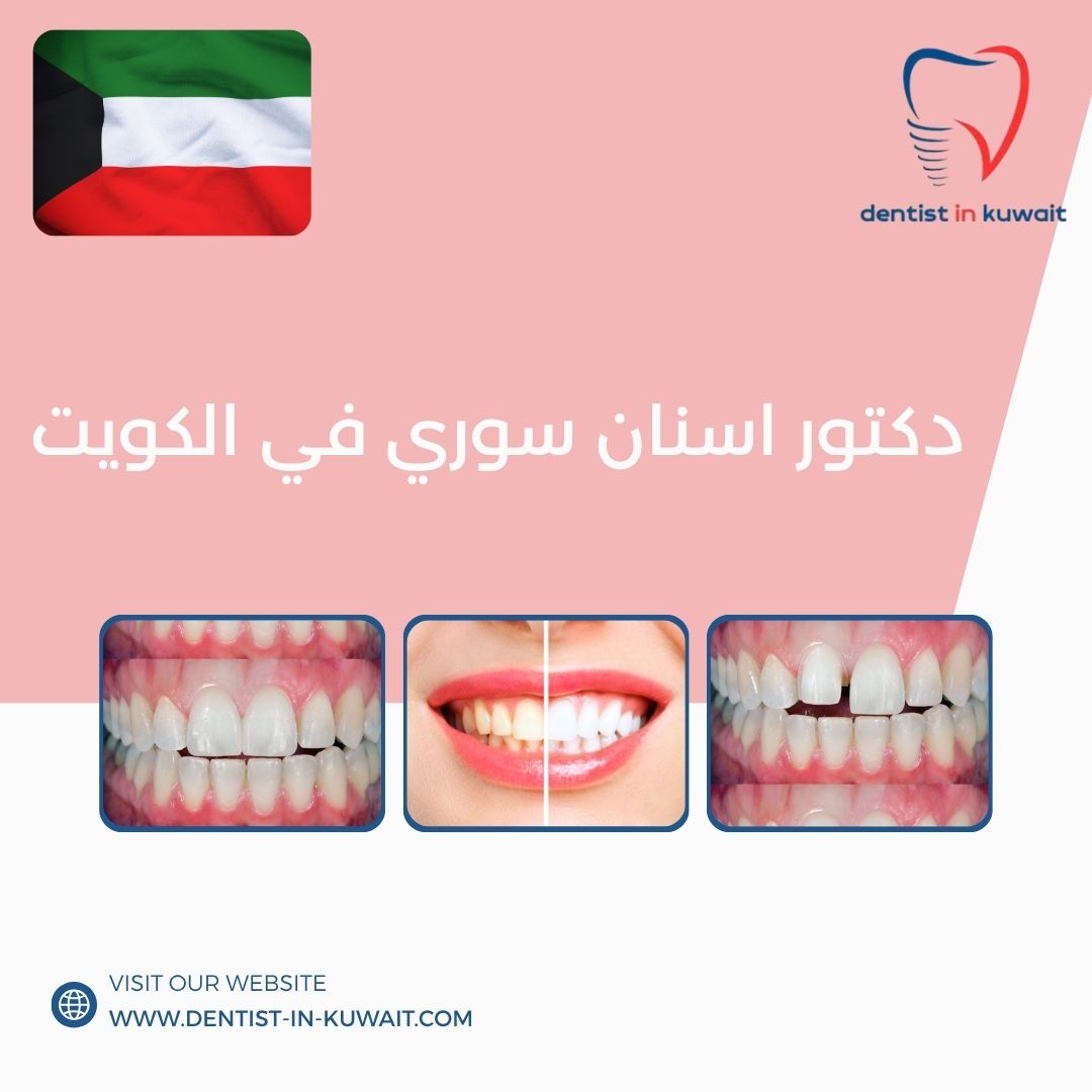 دكتور اسنان سوري في الكويت