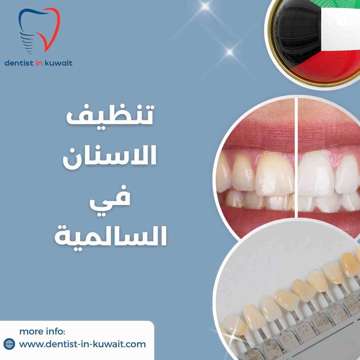 تنظيف الاسنان في السالمية