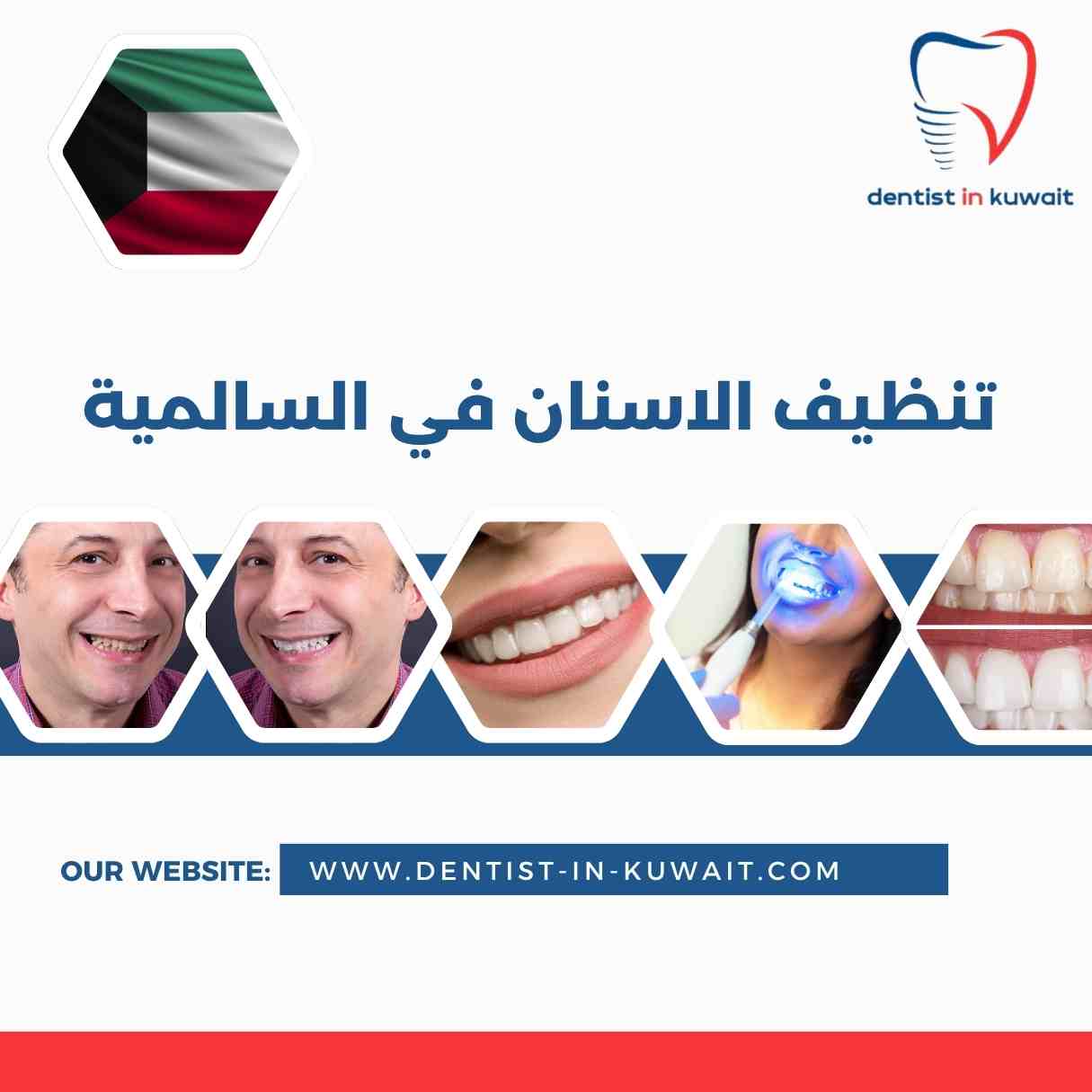 تنظيف الاسنان في السالمية