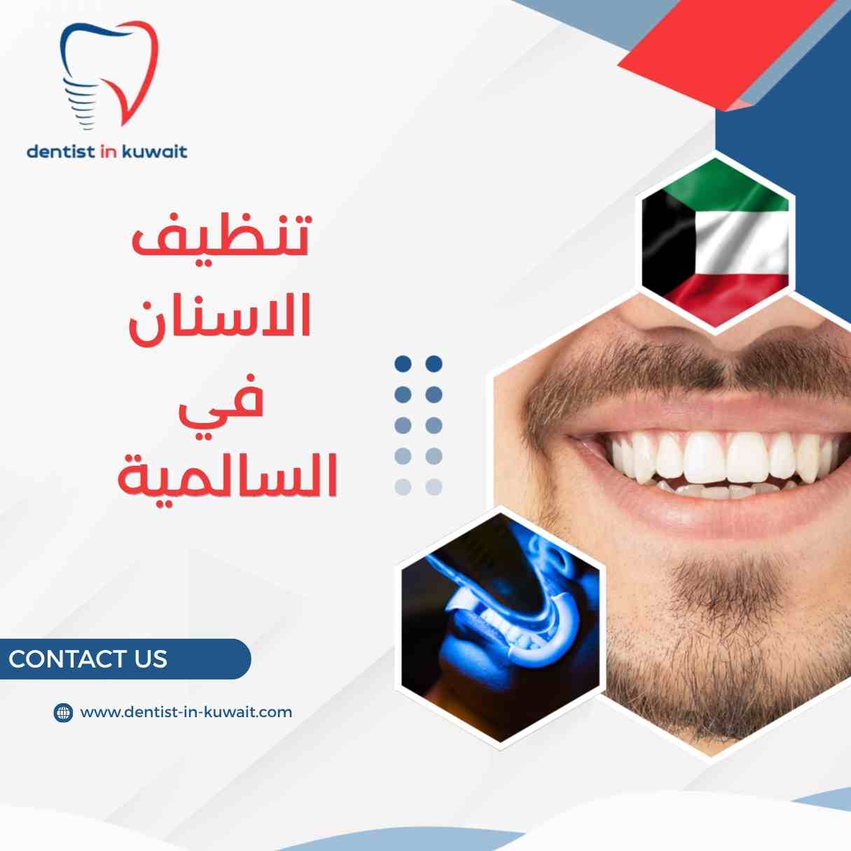 تنظيف الاسنان في السالمية