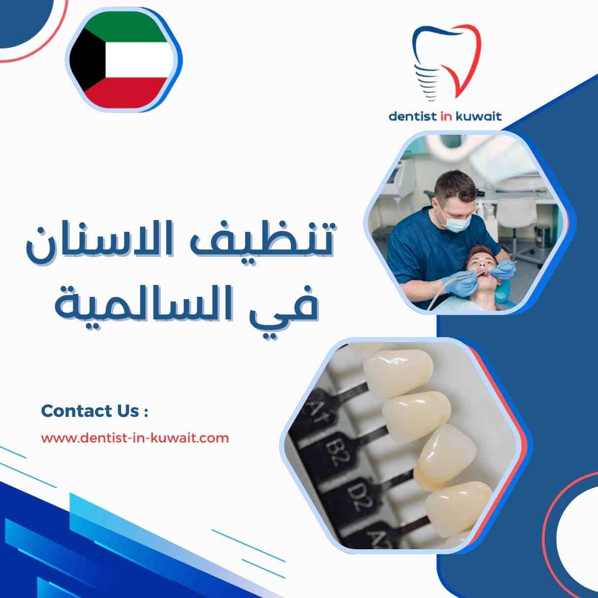 تنظيف الاسنان في السالمية
