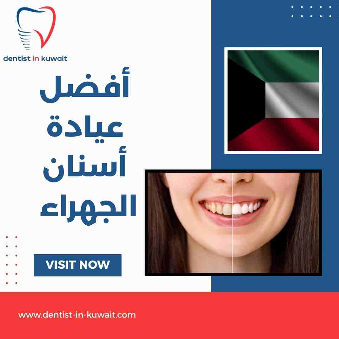 أفضل عيادة أسنان الجهراء
