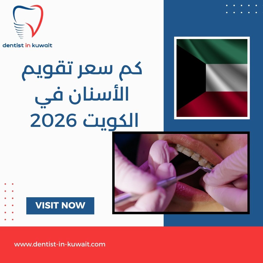 كم سعر تقويم الأسنان في الكويت 2026
