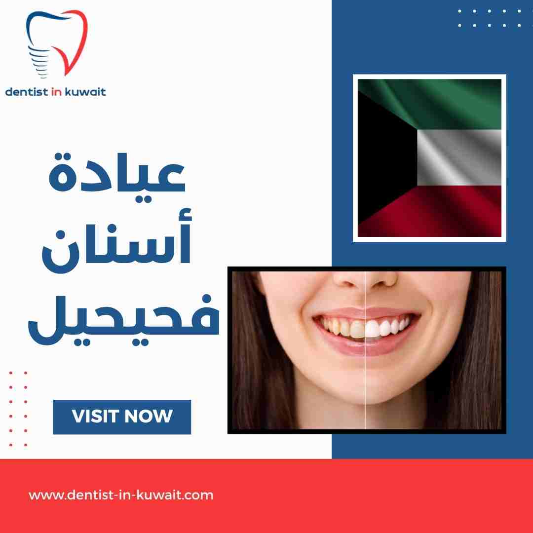 عيادة أسنان فحيحيل