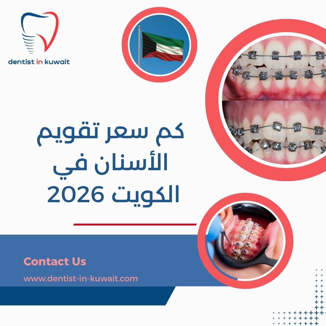 كم سعر تقويم الأسنان في الكويت 2026