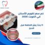 كم سعر تقويم الأسنان في الكويت 2026